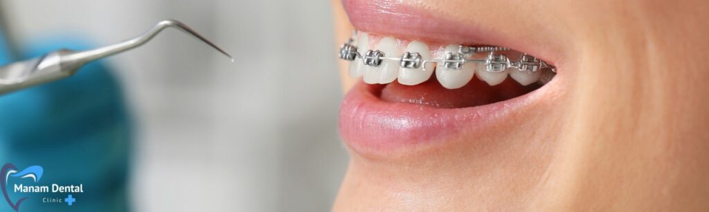 orthodontics dental